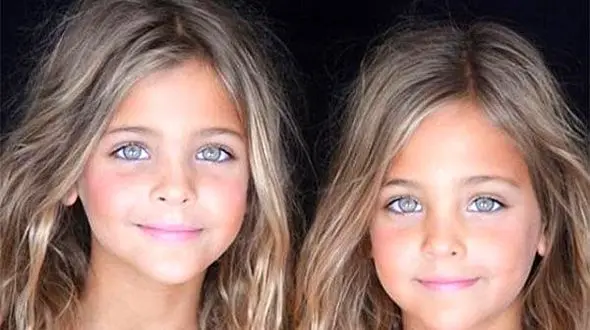 دختری با چهره خاص اینستاگرام را تسخیر کرد+عکس