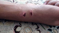 حمله خونین شبانه سگ به پسر 15 ساله + عکس های دلخراش