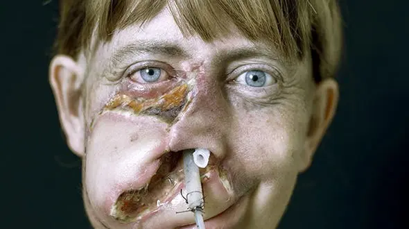 جراحی پلاستیک برای این افراد واجب است! + تصاویر وحشتناک 