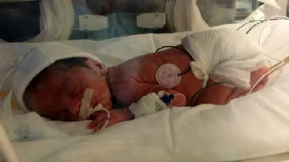 مرگ 4.5 میلیون مادر و نوزاد در هرسال