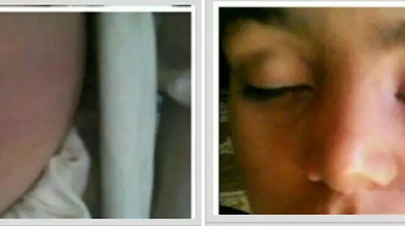 تنبیه بدنی شدید دانش‌آموزی روستایی توسط معلم اش + عکس