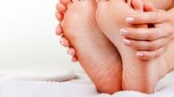 درمان پوسته کف پا با موز