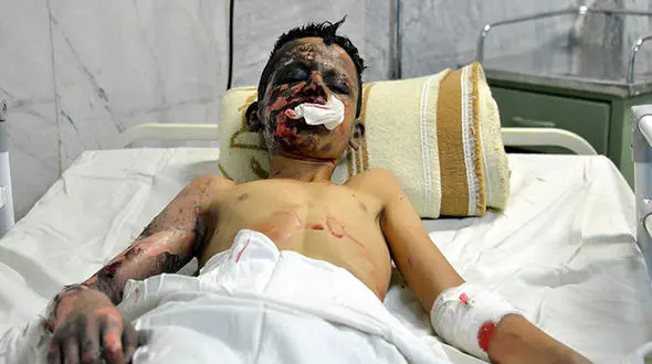 مرگ ۱۵ مرد و یک زن در حوادث چهارشنبه سوری/ از قطع ۲ دست و ۲ پای مرد جوان تا انفجار بمب دست ساز در کلانتری