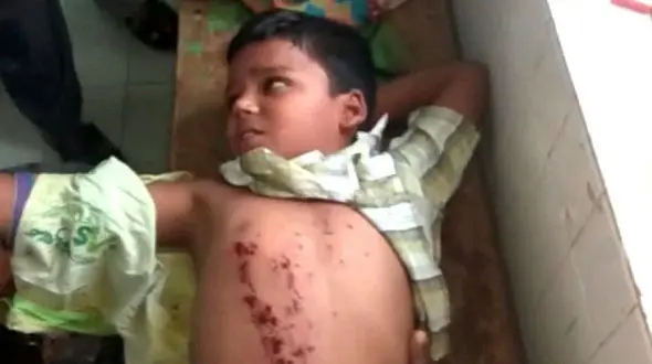 منفجر شدن موبایل در حال شارژ در دستان پسربچه+عکس