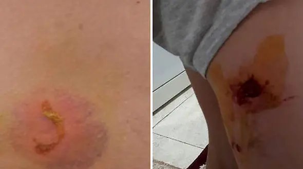 عکس / حمله سگ های ولگرد به پدر و پسر تهرانی