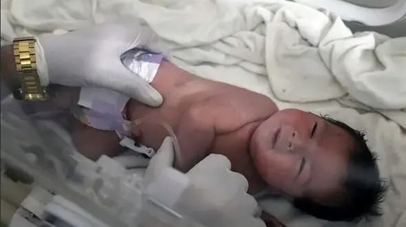 حمله مسلحانه به بیمارستان محل بستری نوزاد متولدشده در زیرآوار در سوریه