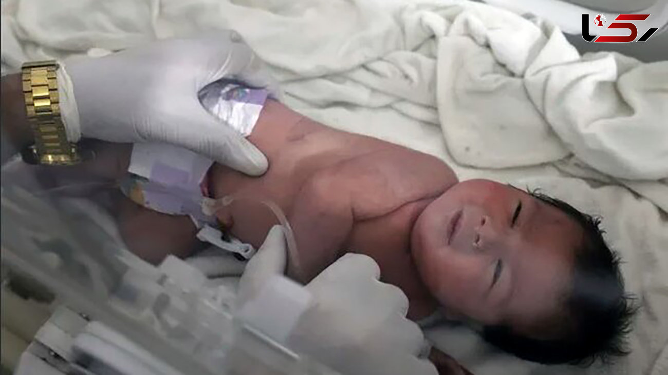 حمله مسلحانه به بیمارستان محل بستری نوزاد متولدشده در زیرآوار در سوریه