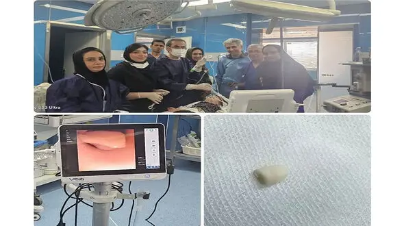 نجات شیرخوار سمنانی از خفگی با بادام زمینی