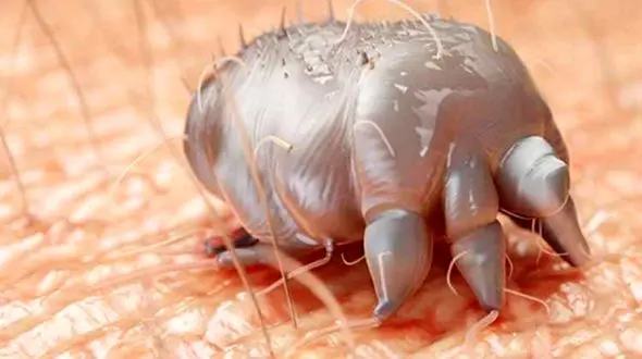 حشراتی که در منافذ پوست صورت همه آدم ها وجود دارد!