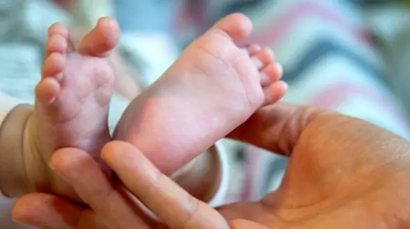 تولد حیرت انگیز دختر عجیب الخلقه / با خنده هایش دنیا را شیفته خود کرد ! + عکس هایی که دلتان را می برد !