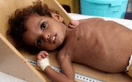 UN warns 400,000 Yemeni children may starve to death in 2021