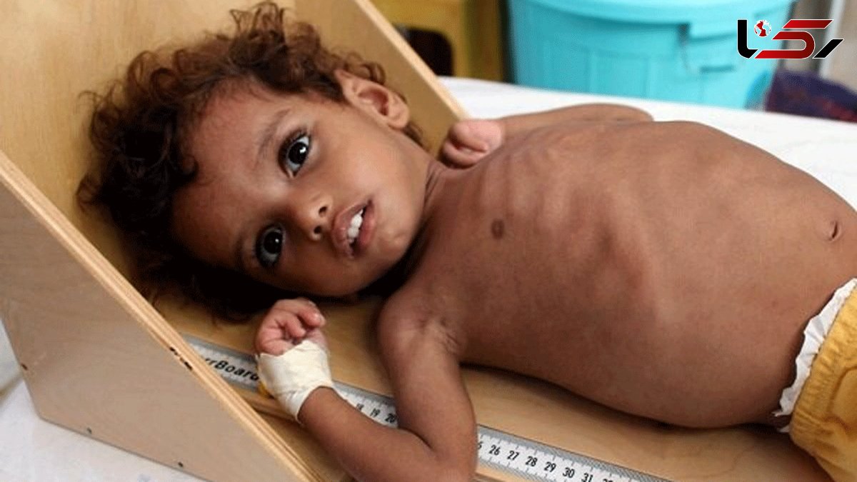 UN warns 400,000 Yemeni children may starve to death in 2021