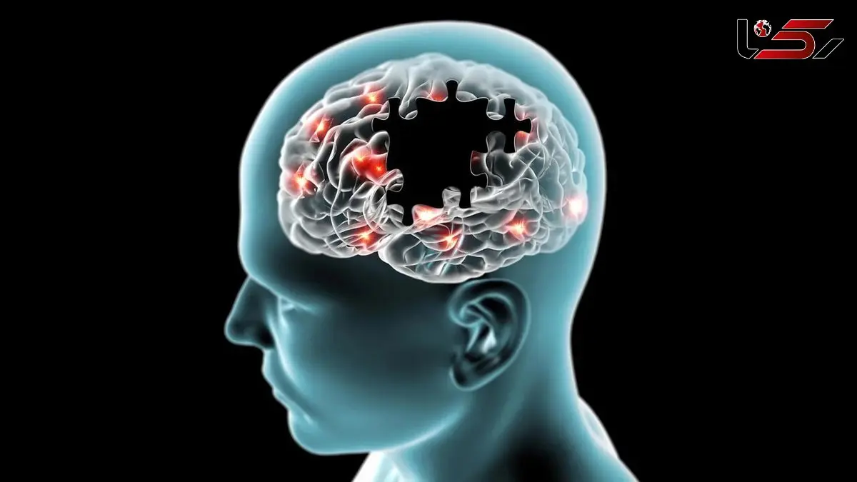 متهم تازه آلزایمر و دارویی که حافظه شما را نجات می‌دهد