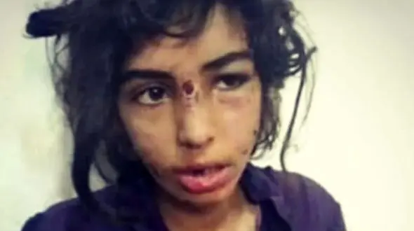 فیلم تلخ ترین گفتگو / مادر اجازه دیدن دختر شکنجه دیده توسط نامادری را ندارد