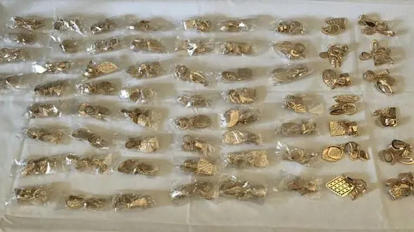 این طلاها در بدن  مسافر مرز بازرگان جاسازی شده بود + عکس 