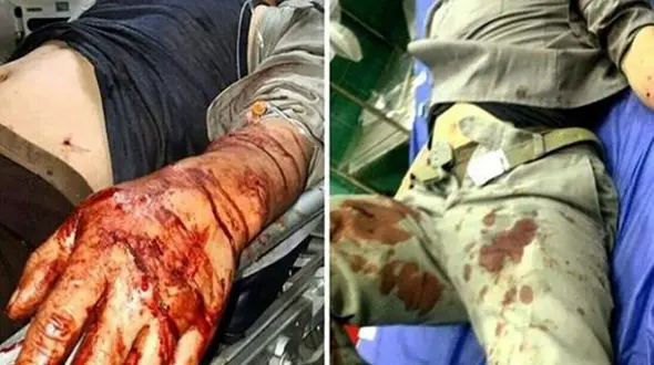 صحنه ای هولناک که شکارچیان سنگدل بهشهر رقم زدند / 4 محیط بان، غرق در خون + عکس