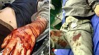 صحنه ای هولناک که شکارچیان سنگدل بهشهر رقم زدند / 4 محیط بان، غرق در خون + عکس