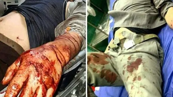 صحنه ای هولناک که شکارچیان سنگدل بهشهر رقم زدند / 4 محیط بان، غرق در خون + عکس