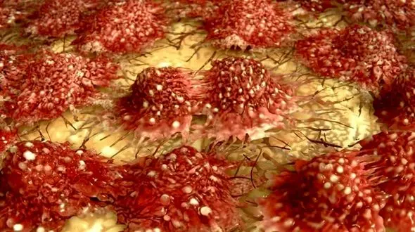 قاتل جان مردان را بشناسید