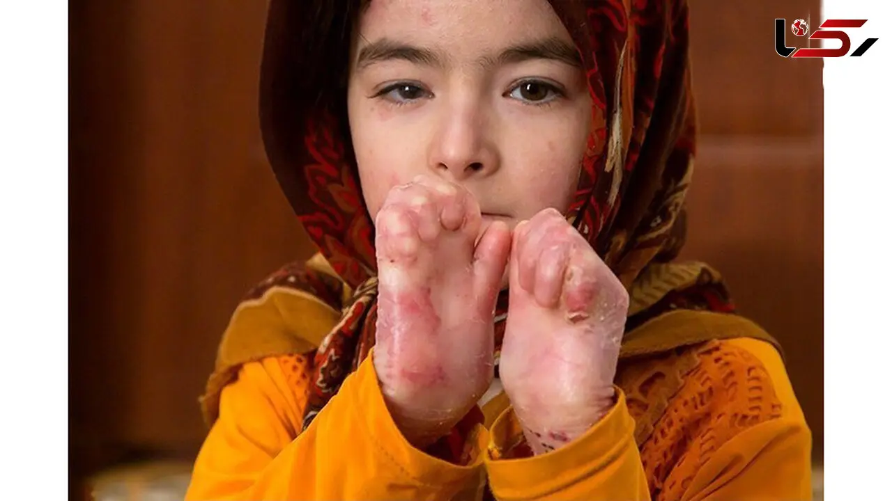 بیمارستان دولتی بیمار پرونه ای را پذیرش نکرد/ مرگ نفیسه به خاطر عدم پذیرش بیمارستان