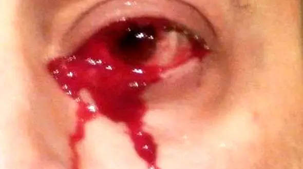 خون گریه کردن مرد ایتالیایی+عکس باورکردنی