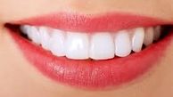 لبخندی زیبا با راهکارهای سفیدکردن دندان ها 