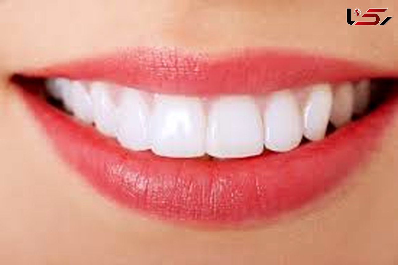 لبخندی زیبا با راهکارهای سفیدکردن دندان ها 