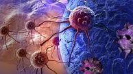 تهیه واکسن جدید سرطان از تومورها
