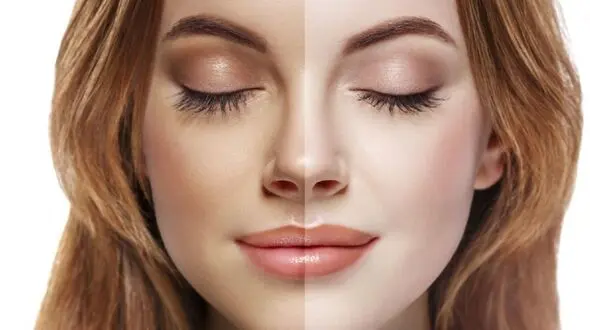 تغییر رنگ پوست‌ چه دلایلی دارد؟