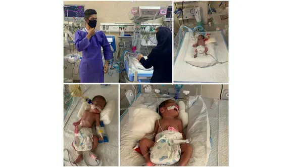 دغدغه های مالی والدین  شش قلوهای کرجی