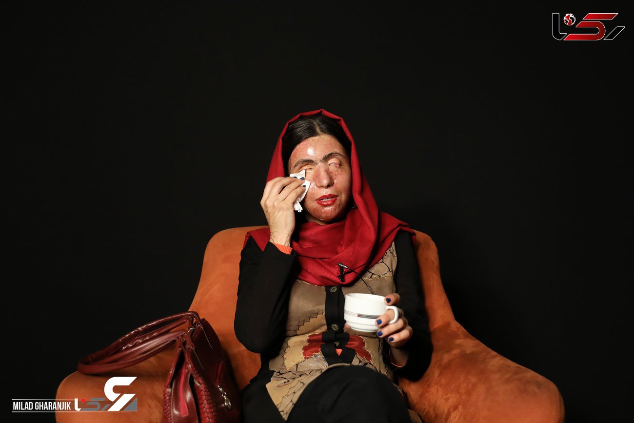 معصومه عطایی زن اسید سوخته از نوید محمدزاده تقاضای کمک کرد+ جزییات