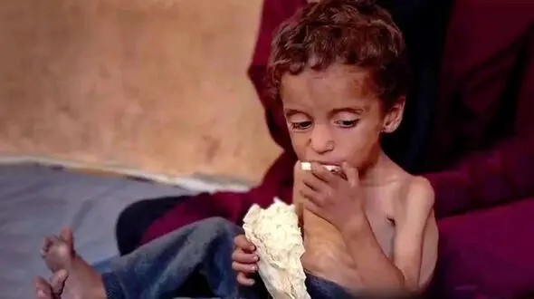بحران گرسنگی غزه در یک قاب دردآور + فیلم