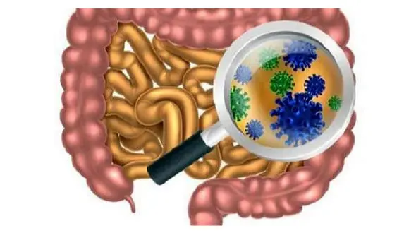 رابطه میکروب های روده و ام اس
