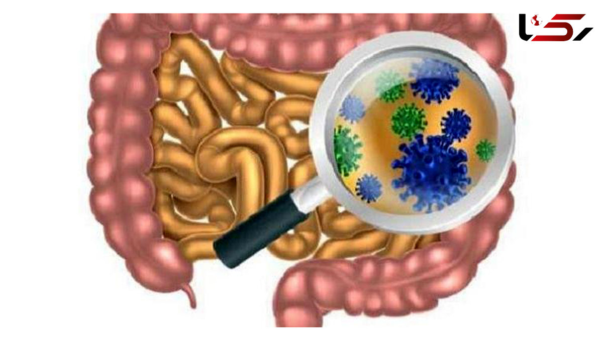 رابطه میکروب های روده و ام اس
