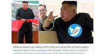 راز جای سوزن روی دست رهبر کره شمالی چیست؟+ عکس