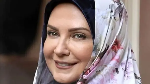 عکس تغییرات شگفت انگیز لعیا زنگنه /  بعد از عمل احتمالی زیبایی چهره اش زیر و رو شد !