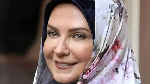 عکس تغییرات شگفت انگیز لعیا زنگنه /  بعد از عمل احتمالی زیبایی چهره اش زیر و رو شد !