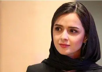 فیلم / بازگشت ترانه علیدوستی : بیماری تمام پوست بدنم را از بین برد! / خودمو تو آینه نمیشناختم  /  یکسال مخفی شدم ! / نمیدونستم چهرم برمیگرده ...