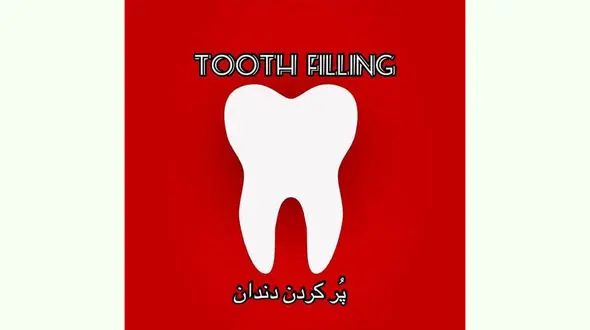 پر کردن دندان با آمالگام (amalgam) + فیلم 