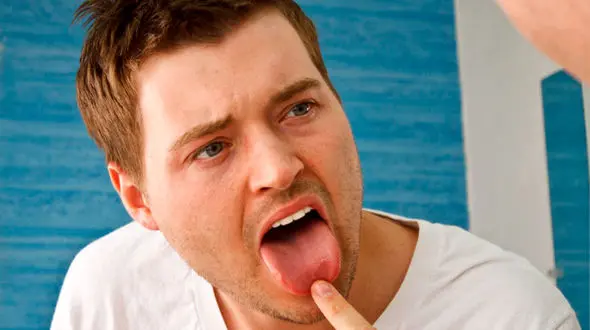 تلخی دهان نشانه چه بیماری هایی است؟