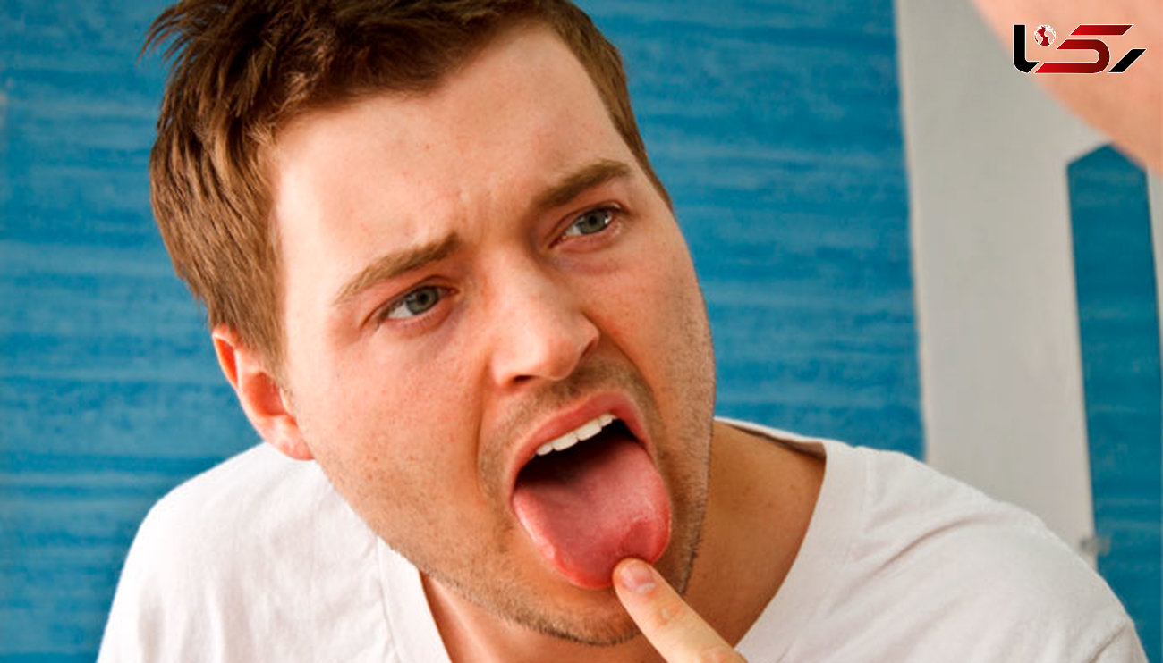 تلخی دهان نشانه چه بیماری هایی است؟