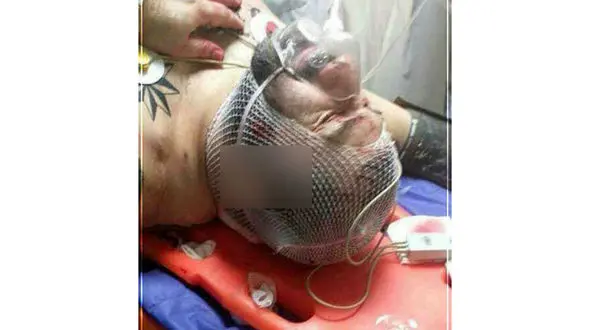 نخستن فیلم از لحظه حمله 6 مرد نقابدار به هانی کرده / گزارش اختصاصی از بیمارستان سینا + فیلم و عکس