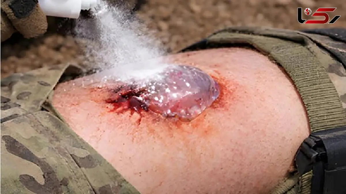 توقف خونریزی فقط در یک ثانیه