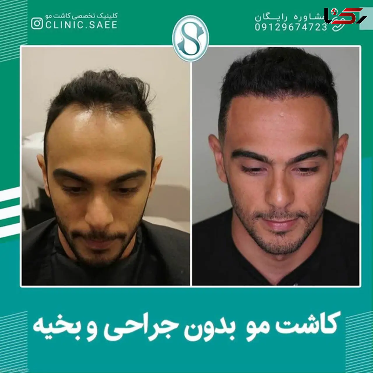 روش‌های جوانسازی و پاکسازی صورت