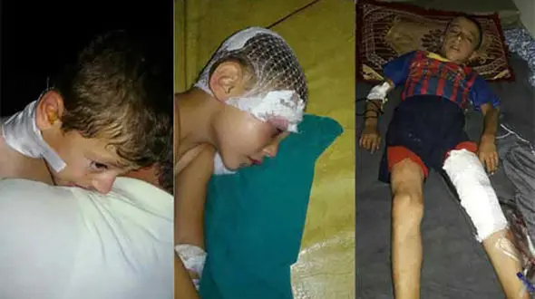 کشته شدن وحشتناک 15 کودک روستایی  (تصاویر+16) 