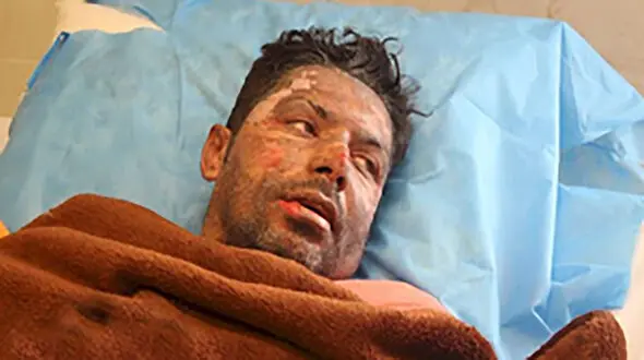 سوختن وحشتناک آتش نشان داوطلب که در راه خاموش کردن ارتفاعات زاگرس جان داد + عکس
