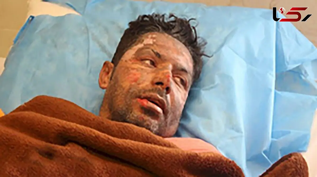 سوختن وحشتناک آتش نشان داوطلب که در راه خاموش کردن ارتفاعات زاگرس جان داد + عکس
