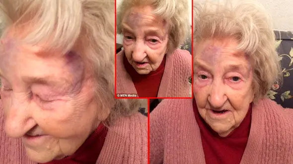 سرقت وحشیانه حلقه ازدواج پیرزن 87 ساله + عکس