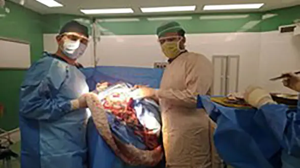 خارج کردن توده مویی از شکم پسر 13 ساله بجنوردی در بیمارستان ساری +عکس