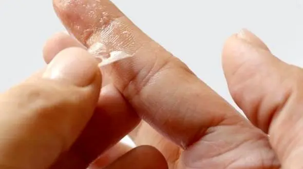 ترفندهای پاک کردن چسب قطره ای از روی پوست